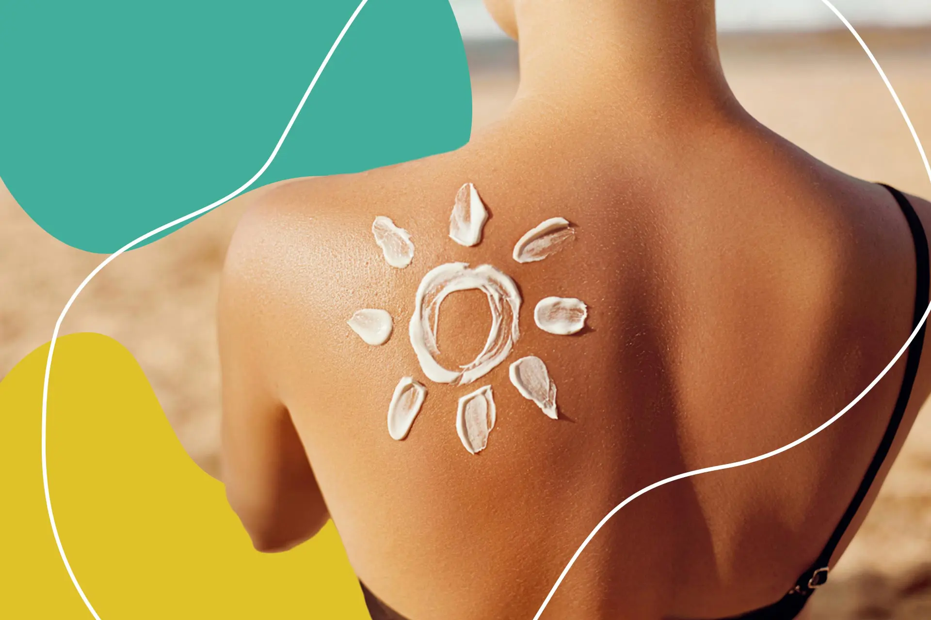 How to Make a Sunburn Treatment Home Remedy