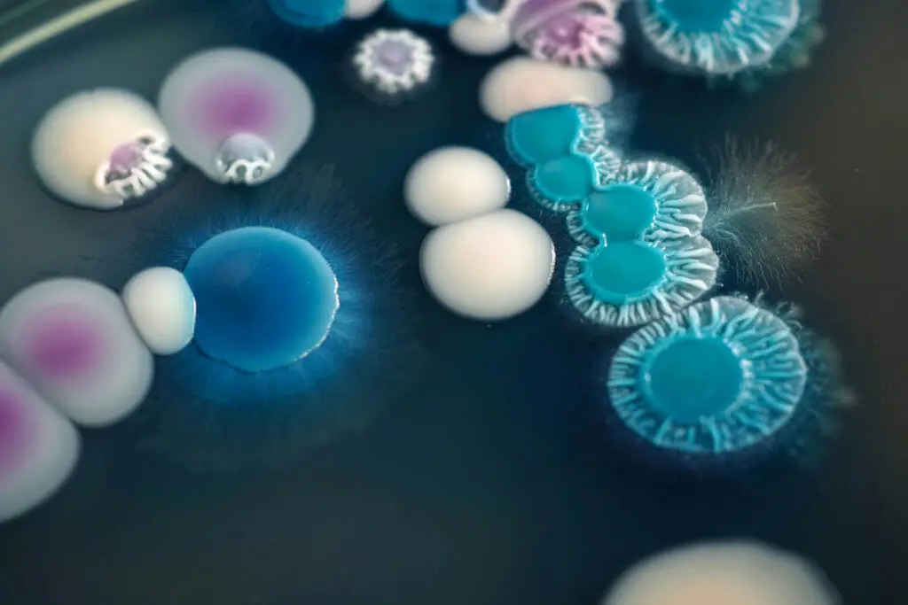 Candida infection under the microscope.