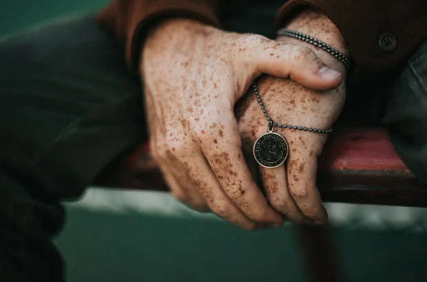 Age spots can make skin look older.