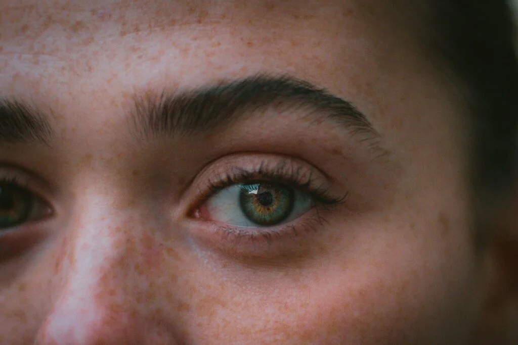 undereyes