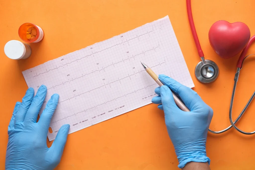 Gloved hands taking notes on an ESG graph next to a pill bottle and stethoscope