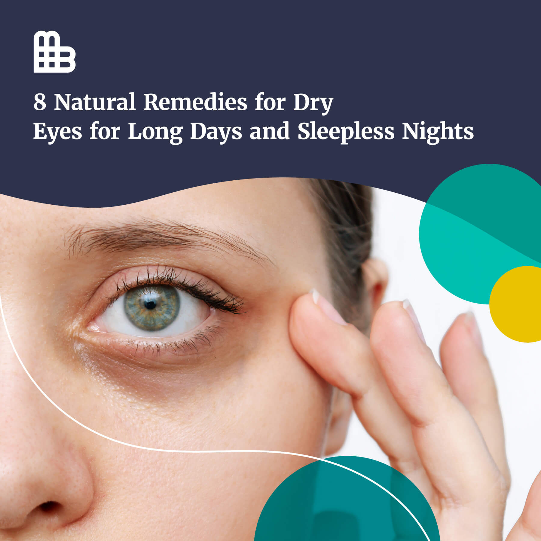 8 Natural Remedies for Dry Eyes for Long Days and Sleepless Nights