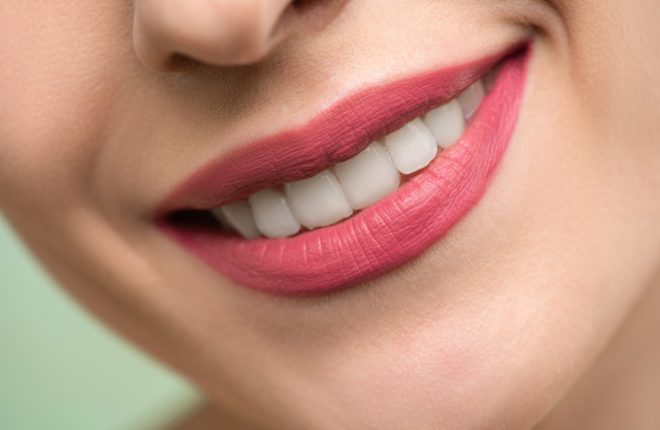 Is Whitening Your Teeth Worth It