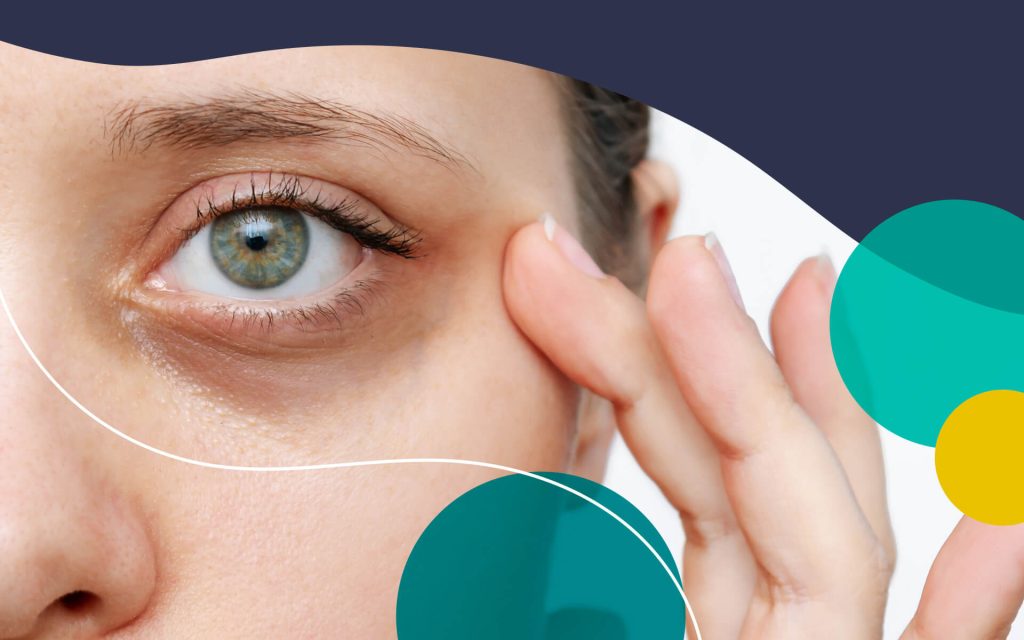 8 Natural Remedies for Dry Eyes for Long Days and Sleepless Nights