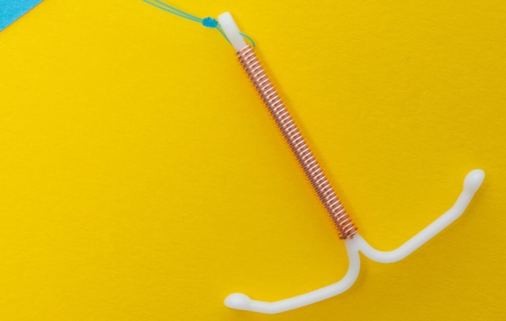 IUD implant.