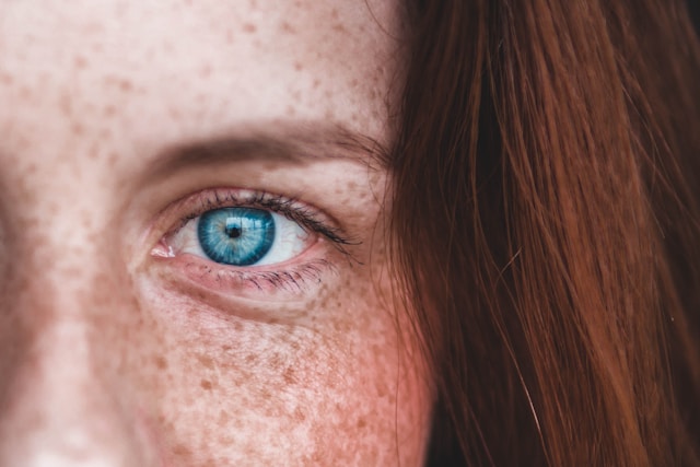 A woman with freckles and blue eyes pictured