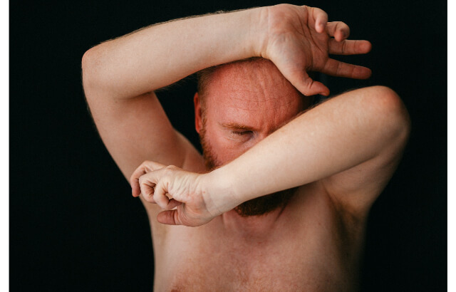 Man with arms up and face red from hot flashes.