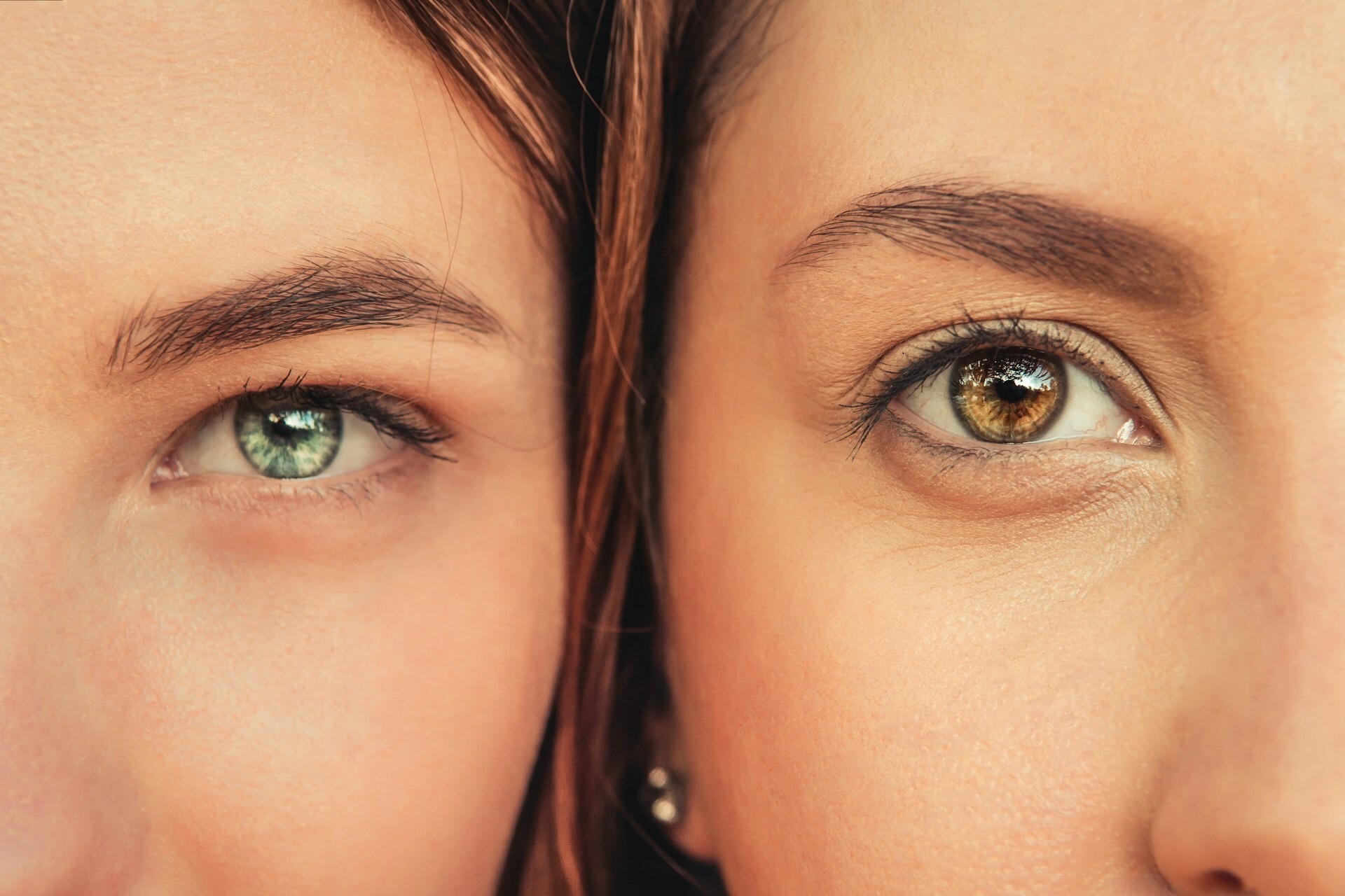 eye bags vs dark circles