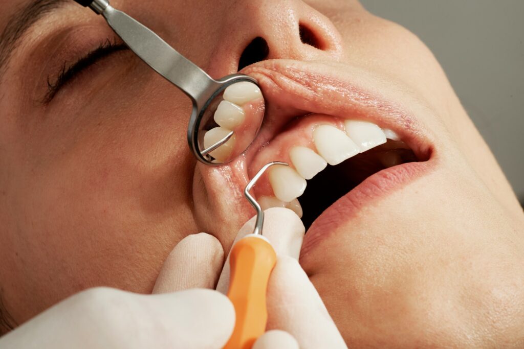 A person being checked by the dentist for the cause of sensitive teeth to determine its remedies